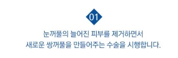 탄력있는 눈매로 확실하게 젊어지는 JW정원성형외과 상안검성형 관련 이미지 3