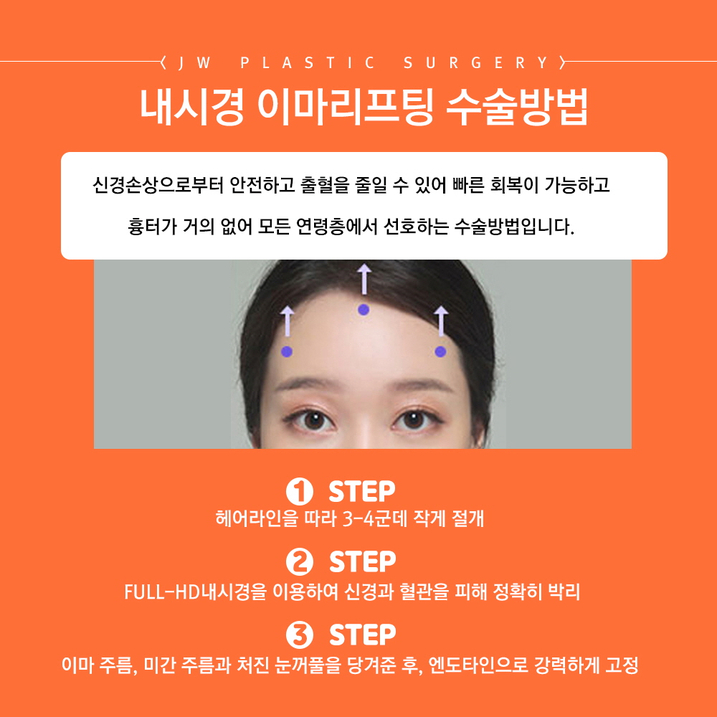 Endoscopic Forehead Lift, Improving a Drooping and Depressed Look to Complete a Youthful Appearance image 5