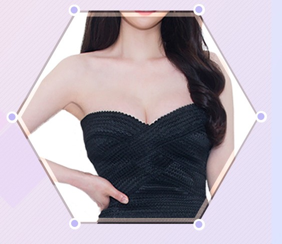 자연스럽고 아름다운 비율, JW정원 가슴축소수술로 관련 이미지 4