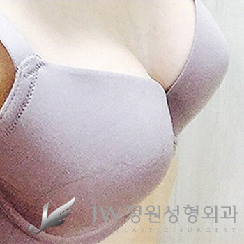 JW정원성형외과 모티바가슴성형 내몸에 꼭 맞는 선택 관련 이미지 1