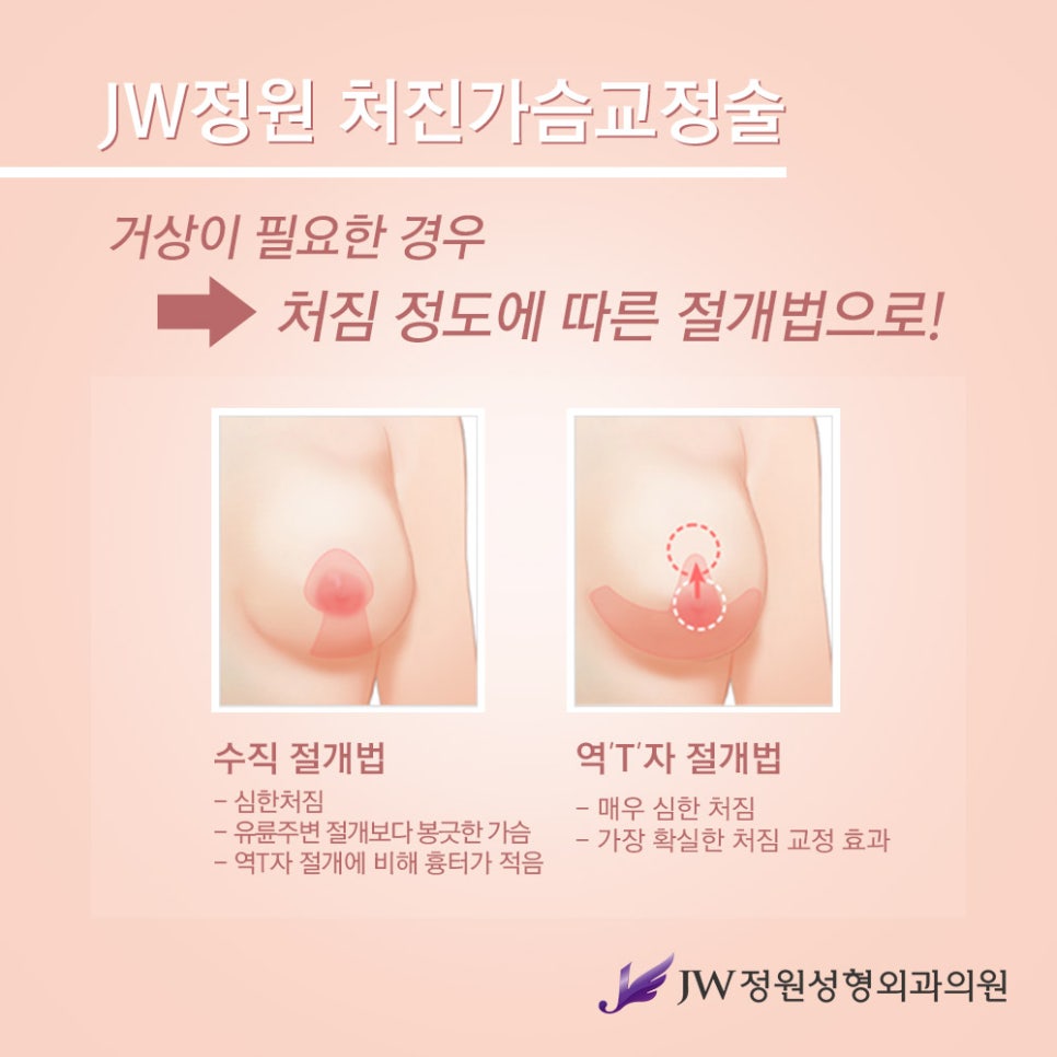 Breast Lift Surgery for Drooping Breasts, with a Natural and Firm Result image 7