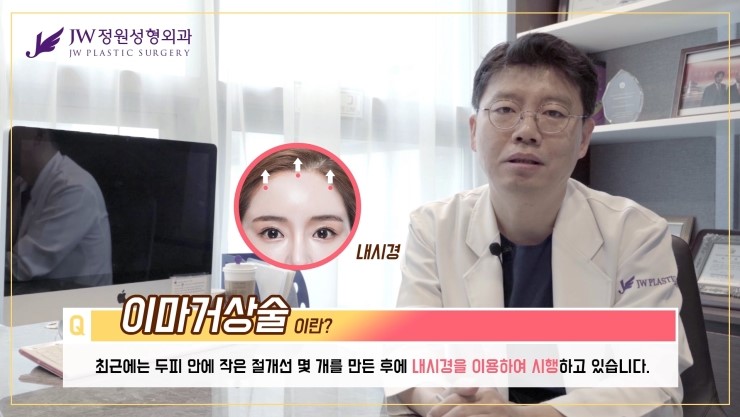 [JW정원성형외과] 눈매교정 후 두꺼워 보이는 눈두덩이, 어떻게 없앨 수 있을까요? 관련 이미지 23