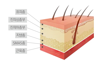 [JW정원성형외과]주름개선 & 어려지는 피부, 더블로리프팅!! 관련 이미지 2