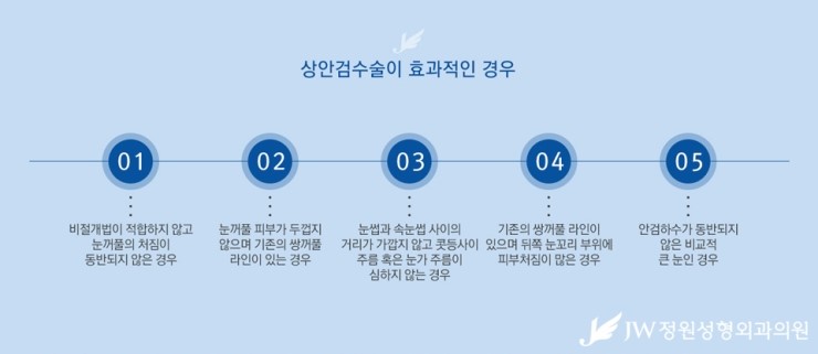[JW정원성형외과] 처진 눈꺼풀을 탄력 있는 눈매로! 상안검성형 관련 이미지 4