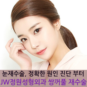 눈재수술! 병원선택부터 신중하게! JW정원성형외과 쌍꺼풀 재수술 관련 이미지 1
