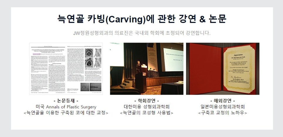 코재건수술, 자가늑연골로 견고한 콧대만들기 관련 이미지 8
