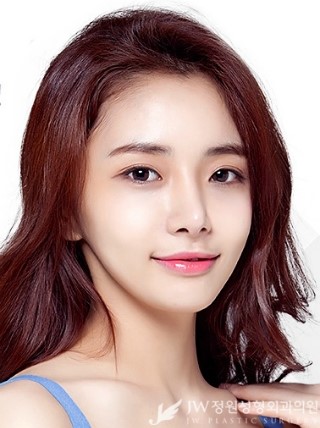 맑고 깨끗한 동안피부▶▷JW정원성형외과만의 노하우로 완성! 관련 이미지 1