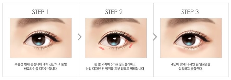발랄하고 사랑스러운 이미지 완성, JW정원 눈밑애교! 관련 이미지 3