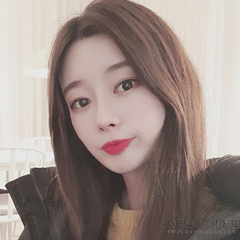 비중격만곡증 수술후기 아름다운 코라인까지 관련 이미지 1
