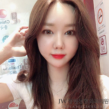 나에게 딱맞는 코수술, 3D맞춤보형물로 자연스럽게 관련 이미지 2