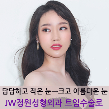 작고 답답한 눈매에서 크고 아름다운 눈매로! JW정원성형외과 트임수술 관련 이미지 1
