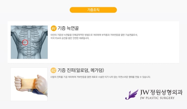[JW정원성형외과] 낮은코를 개선해주는 낮은코성형 알아봐요! 관련 이미지 6