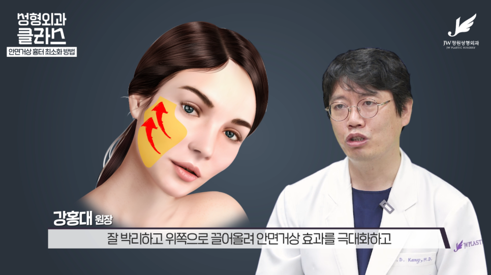 안면거상술후기 흉터 걱정 없이 깔끔하게!  【강남 JW정원성형외과】 관련 이미지 9
