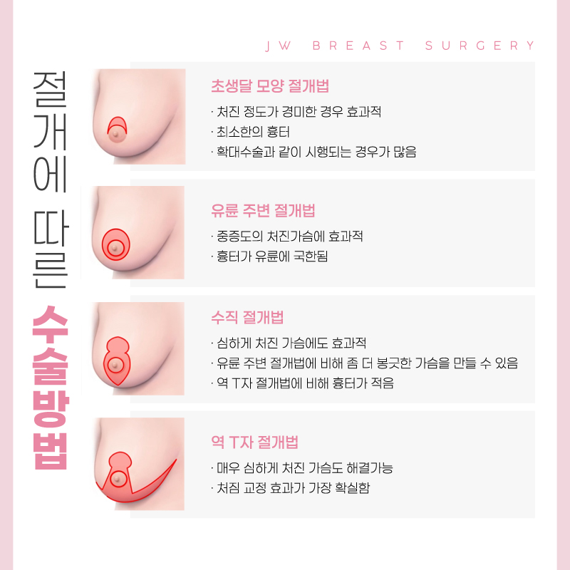 Take a Thorough Look at Breast Lift Surgery Prices image 3