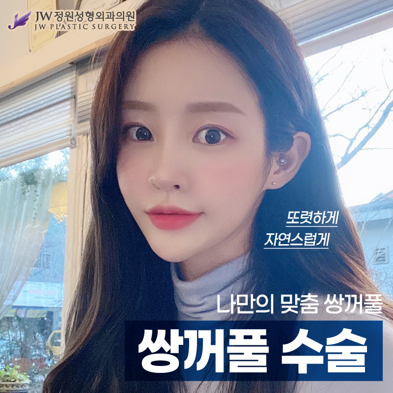 쌍수잘하는곳 자연스러운 화려한 눈매를 바란다면 관련 이미지 1