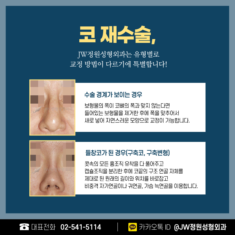강남구축코재수술 신뢰도가 높은 이유 【강남 JW정원성형외과】 관련 이미지 5