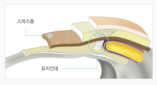 미니거상과 전체 안면거상, 나에게 맞는 안면거상술은? 관련 이미지 5