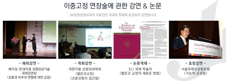 재수술한 코도 말랑하게! JW정원성형외과 핵심기술력 이중고정연장술! 관련 이미지 3