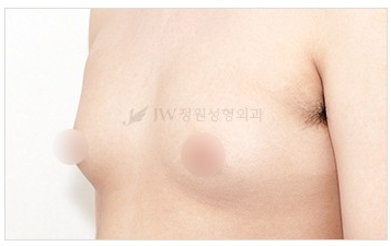남모를 고민 관련 이미지 1