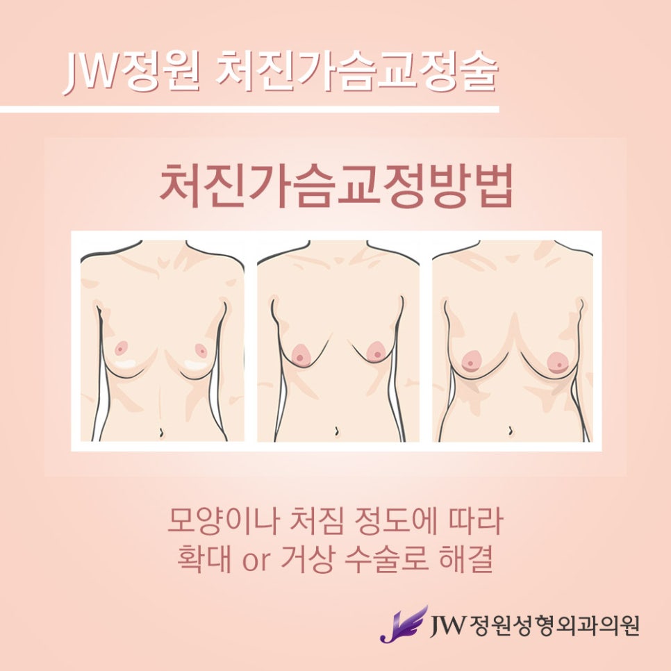 Breast Lift Surgery for Drooping Breasts, with a Natural and Firm Result image 4
