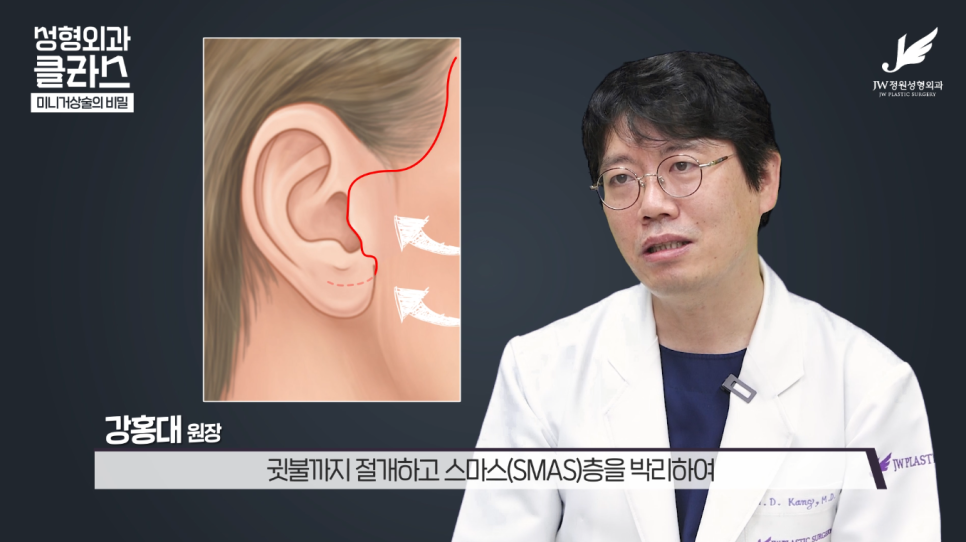 A hospital that is experienced in facelift surgery 【Gangnam JW Garden Plastic Surgery】 image 15