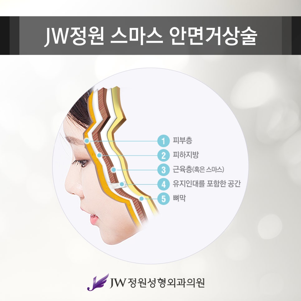 Wrinkle Improvement in Your 40s to 60s: SMAS Facelift Lifting image 2