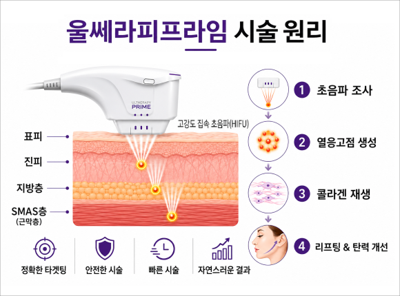 Where Is the Best Place to Get Songpa Ulthera Prime? image 4
