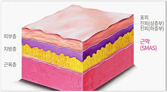 Jamsil Lifting: Not Sure Which Treatment to Choose? image 4