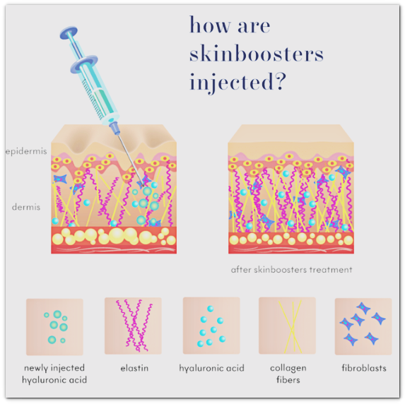 Seokchon-dong Dermatology Care: There Is a Specific Type That Benefits from ECM Skin Boosters image 6