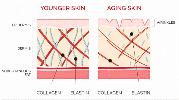 Can Forehead Rejuran Be Effective for Fine Wrinkles? image 2