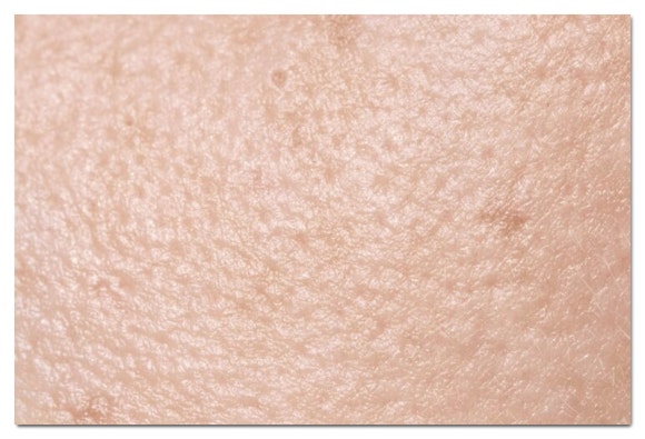 Munjung Station Dermatology: Don’t Just Get Any Procedure—Have the Cause Diagnosed First image 3
