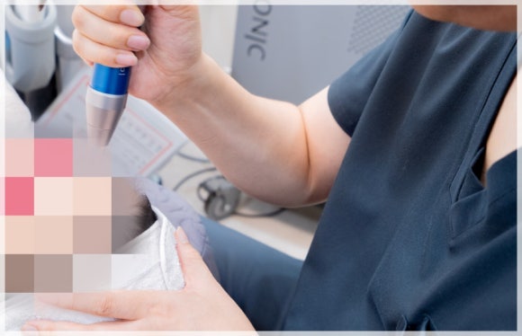 What Are the Benefits of Getting Larapil and Laser Toning Together? image 3