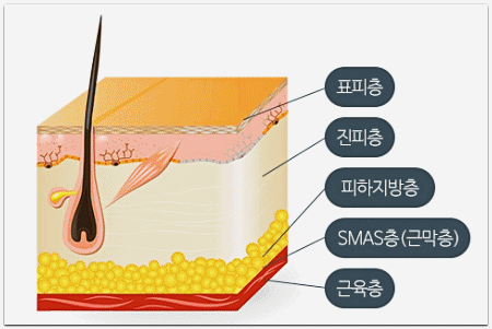 잠실새내역리프팅, 울쎄라 온다 함께 받아도 피부에 무리 없을까? 관련 이미지 8