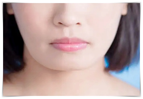What You Must Know Before Getting Square Jaw Botox in Jamsil image 3