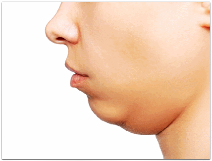Jamsil ONDA Lifting Face and Body Effects, How Much Does It Hurt? image 3