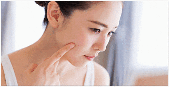 How Can You Tell Whether Acne Dermatology Treatment in Jamsil Is Going Well? image 9