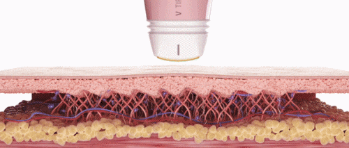 Volnewmer 600-Shot Effect: How Much Can It Cover? image 5