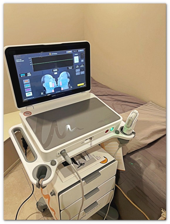 2 Things to Check Before Getting Jamsil Ulthera Prime image 1