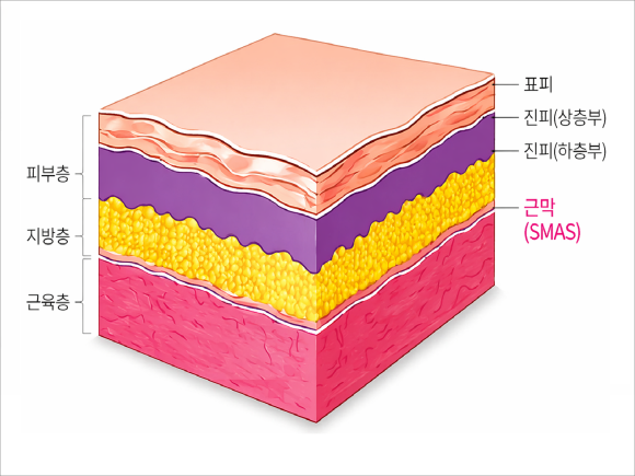 송파 울쎄라피프라임 시술 전 꼭 읽어봐야 할 상세 가이드 관련 이미지 2