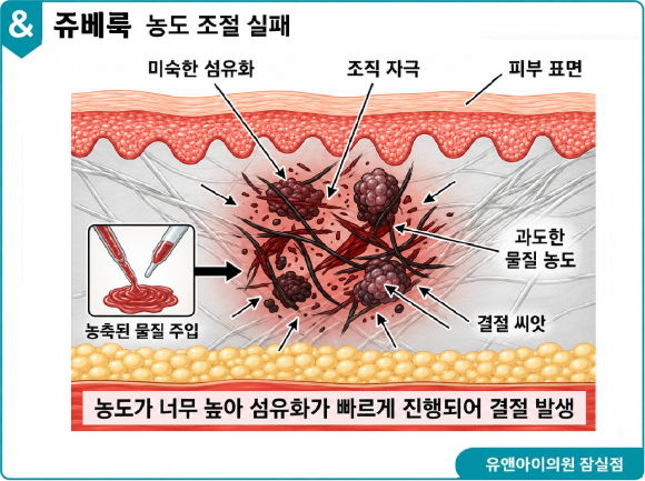 송파 피부과 추천, 넓어진 모공 푸석한 피부엔? 쥬베룩 스킨부스터 효과와 부작용 관련 이미지 5