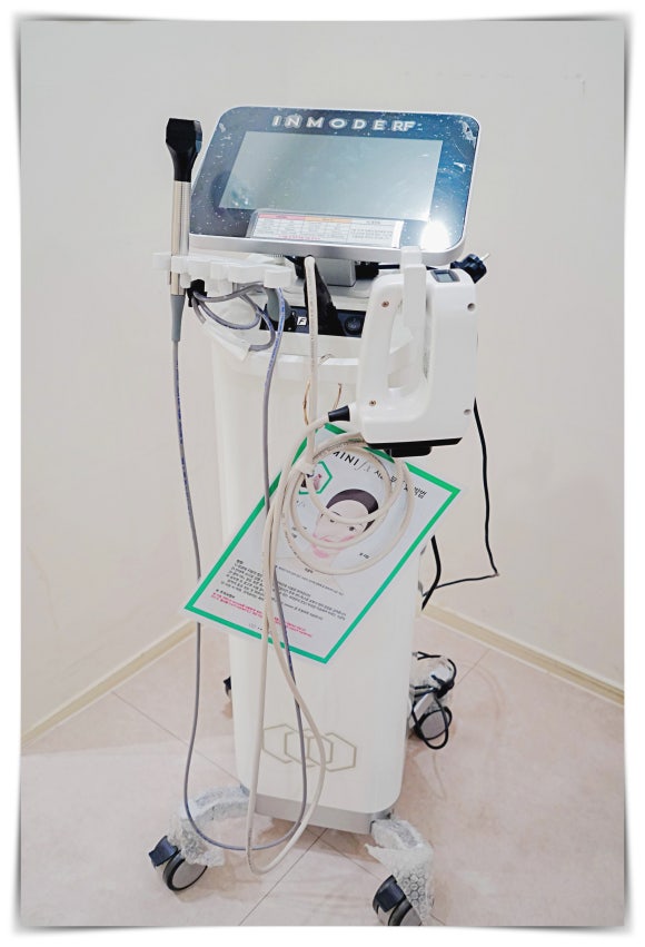 Jamsil InMode Lifting: How to See Results for Double Chin Fat and Buccal Fat image 2