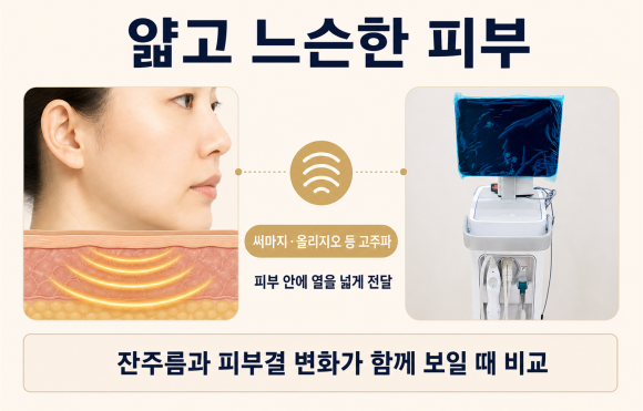 송파 리프팅 추천, 얼굴 처짐 상태에 따라 달라질까? 관련 이미지 4
