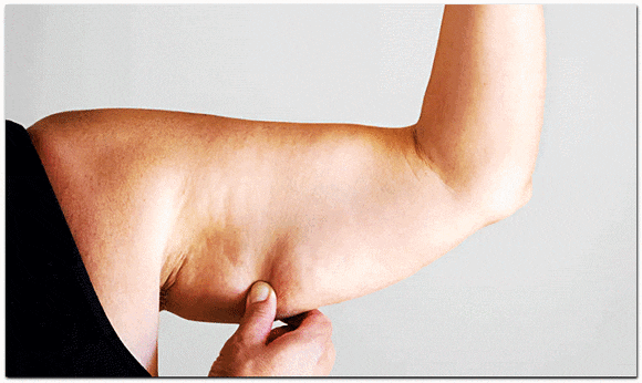 Jamsil ONDA Lifting Face and Body Effects, How Much Does It Hurt? image 5