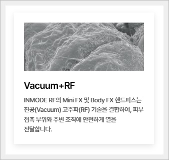 인모드 fx 심부볼 제거 효과는? 관련 이미지 3