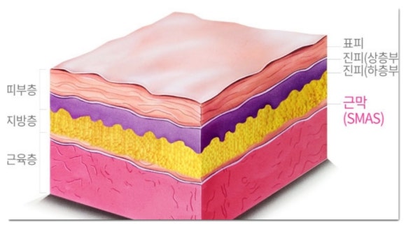 Songpa Ultherapy Lifting: Why the Procedure Is Performed While Viewing the Inside of the Skin image 2