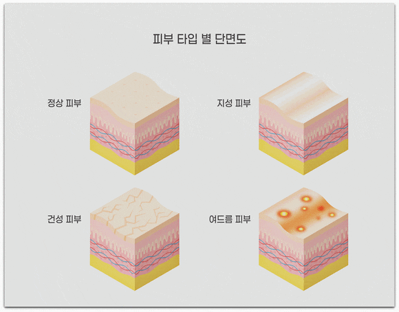 문정역 피부과 진료, 그동안 왜 관리해도 효과 못 봤을까? 관련 이미지 2