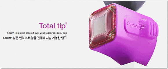 Summary of the Effects of Different Thermage Lifting Tips in Songpa image 6