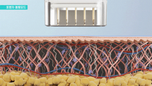 Acne Exosome Treatment: If You're Wondering Whether It Works as Well as the Many Reviews Say image 5
