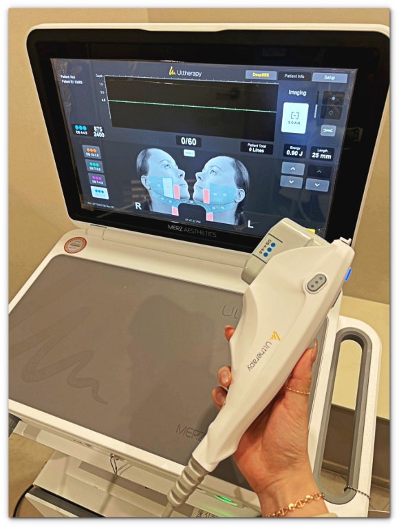 2 Things to Check Before Getting Jamsil Ulthera Prime image 2