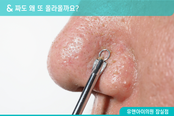 잠실아쿠아필 블랙헤드 피지 정리에 효과 볼 수 있을까? 관련 이미지 1